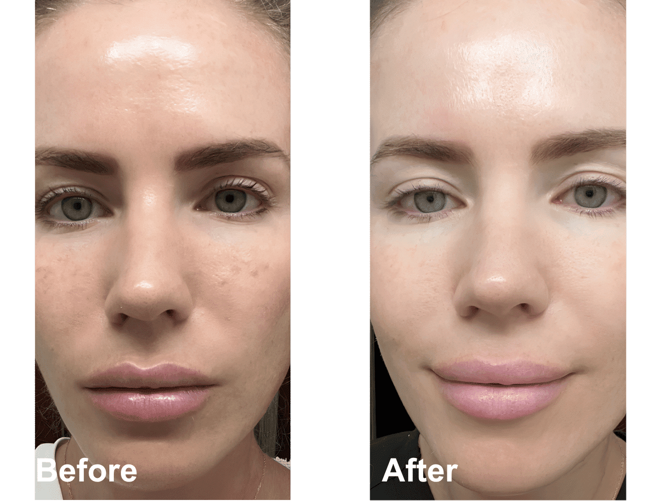 Before and after skincare results showing smoother, clearer complexion.